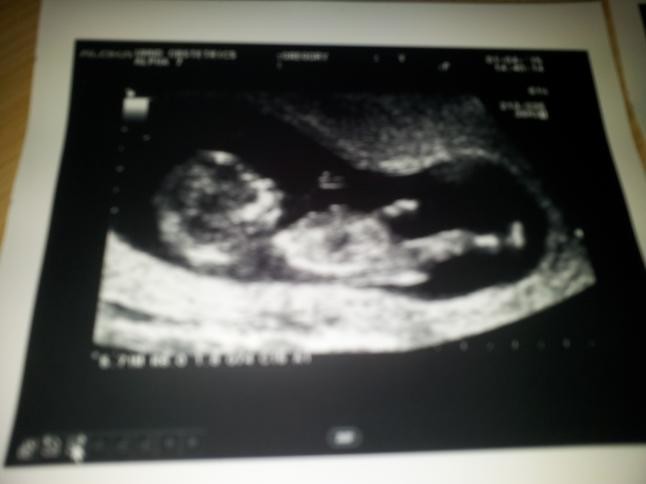 A Chance At Last Scan